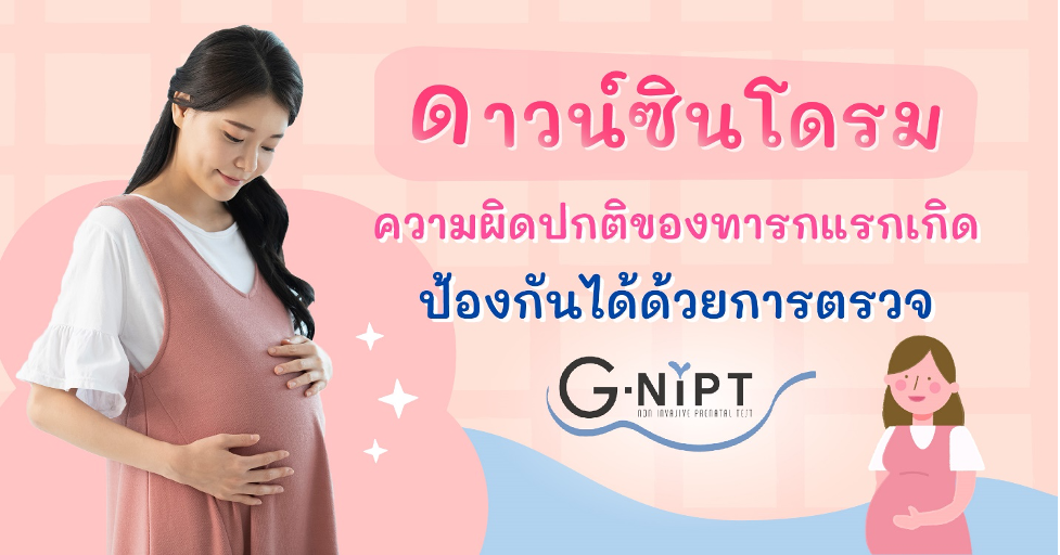 ดาวน์ซินโดรม ความผิดปกติของทารกแรกเกิด ป้องกันได้ด้วยการตรวจ G-Nipt