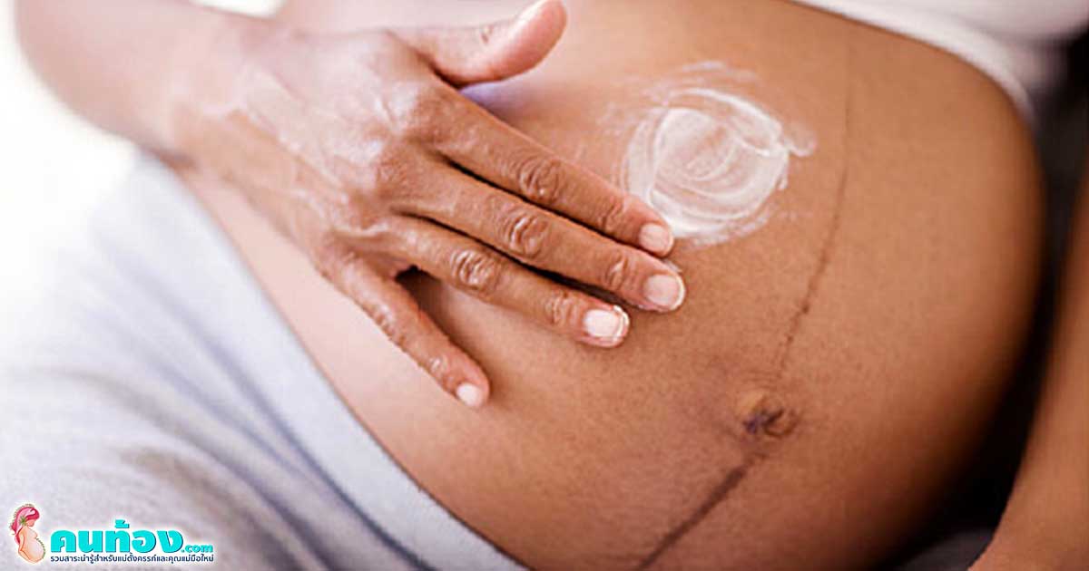 รีวิวครีมทาหน้าท้อง แนะนำครีมที่ใช้ดีและปลอดภัย สำหรับคุณแม่ตั้งครรภ์